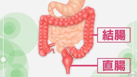 結腸と直腸の2つに分けられる大腸
