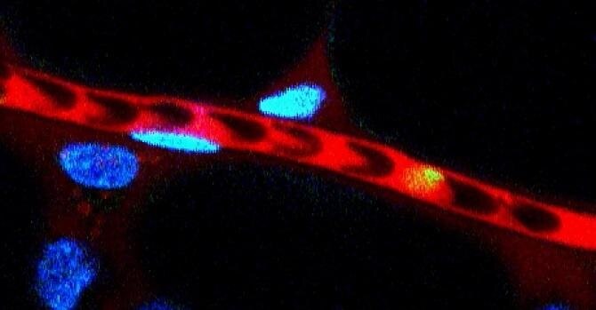 微細な血管の中を柔軟に変形しながら通過する赤血球（青色）