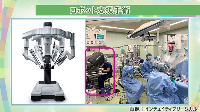 ロボット支援手術