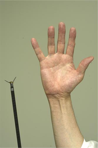 人間の手と手術ロボットの「手」の比較