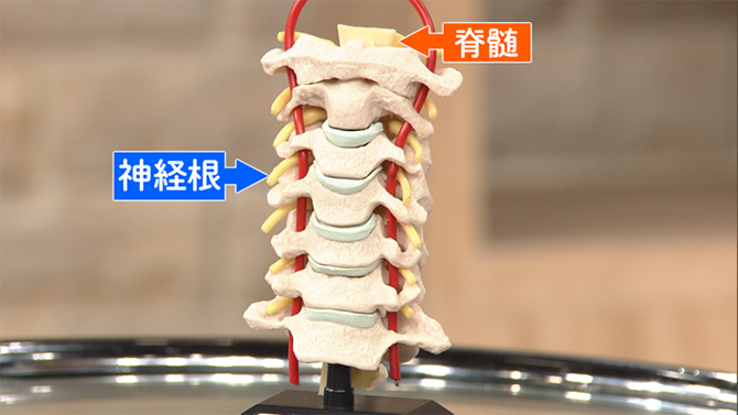 脊髄と神経根の場所