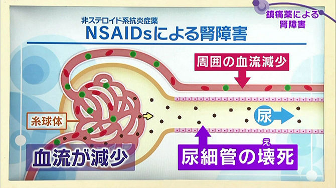 NSAIDsによる腎障害で尿細管が壊死してしまうメカニズム