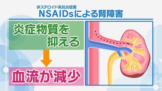 非ステロイド系抗炎症薬（NSAIDs）による腎障害
