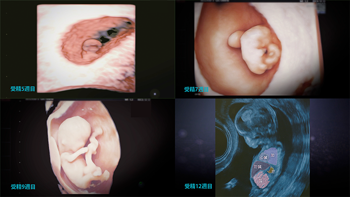 超音波でとらえた胎児の姿。それぞれ受精齢で示している。受精5週目は、通常使われている月経齢で妊娠6週となる。（画像：馬場一憲・埼玉医科大学総合医療センター）
