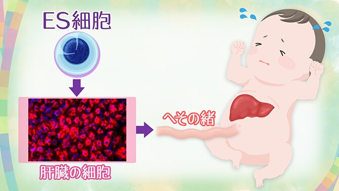 ヒトES細胞からつくった肝臓の細胞を病気の赤ちゃんに注入