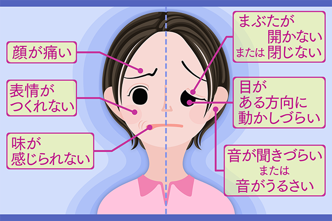 顔の痛み・まひ　原因はウイルスなどによる脳神経の異変