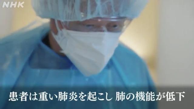 エクモによるコロナ治療で生存率を引き上げた立て役者・竹田晋浩