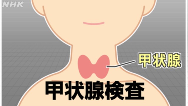 【解説】東日本大震災・原発事故「甲状腺検査」