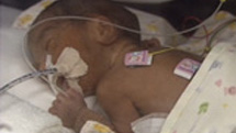 “小さく生まれた命”を救え　～新生児医療の最前線～