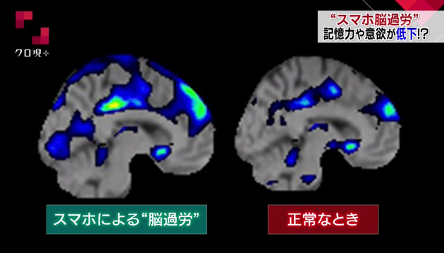 スマホ脳過労とは】記憶力低下や無気力など悪影響が - NHK クローズアップ現代 全記録