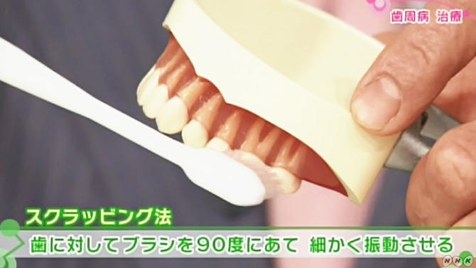 歯周病の原因と治療法とは？歯周病かがわかるチェックリスト | NHK健康チャンネル