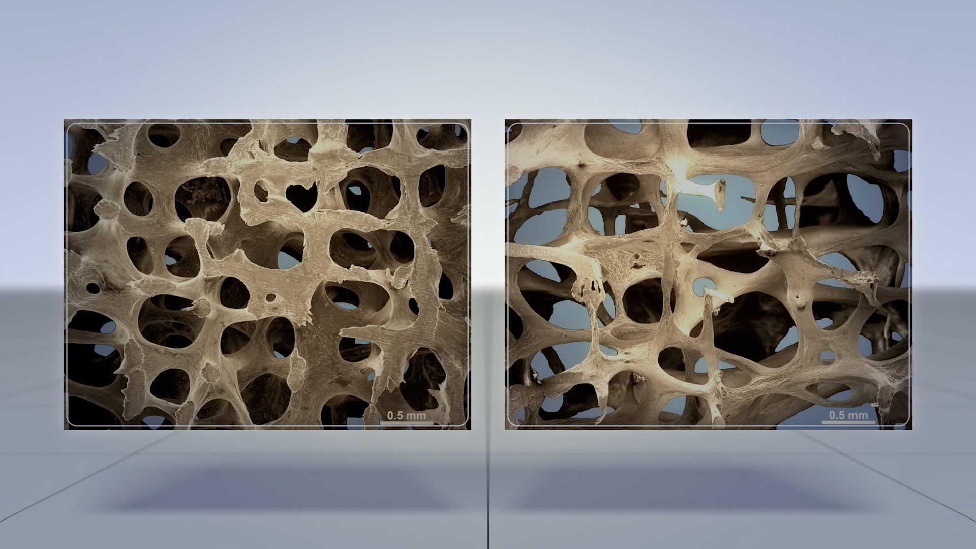 正常な骨（左）と骨粗しょう症の骨。（画像：Images of normal & osteoporotic bone courtesy of Professor Tim Arnett, UCL ）