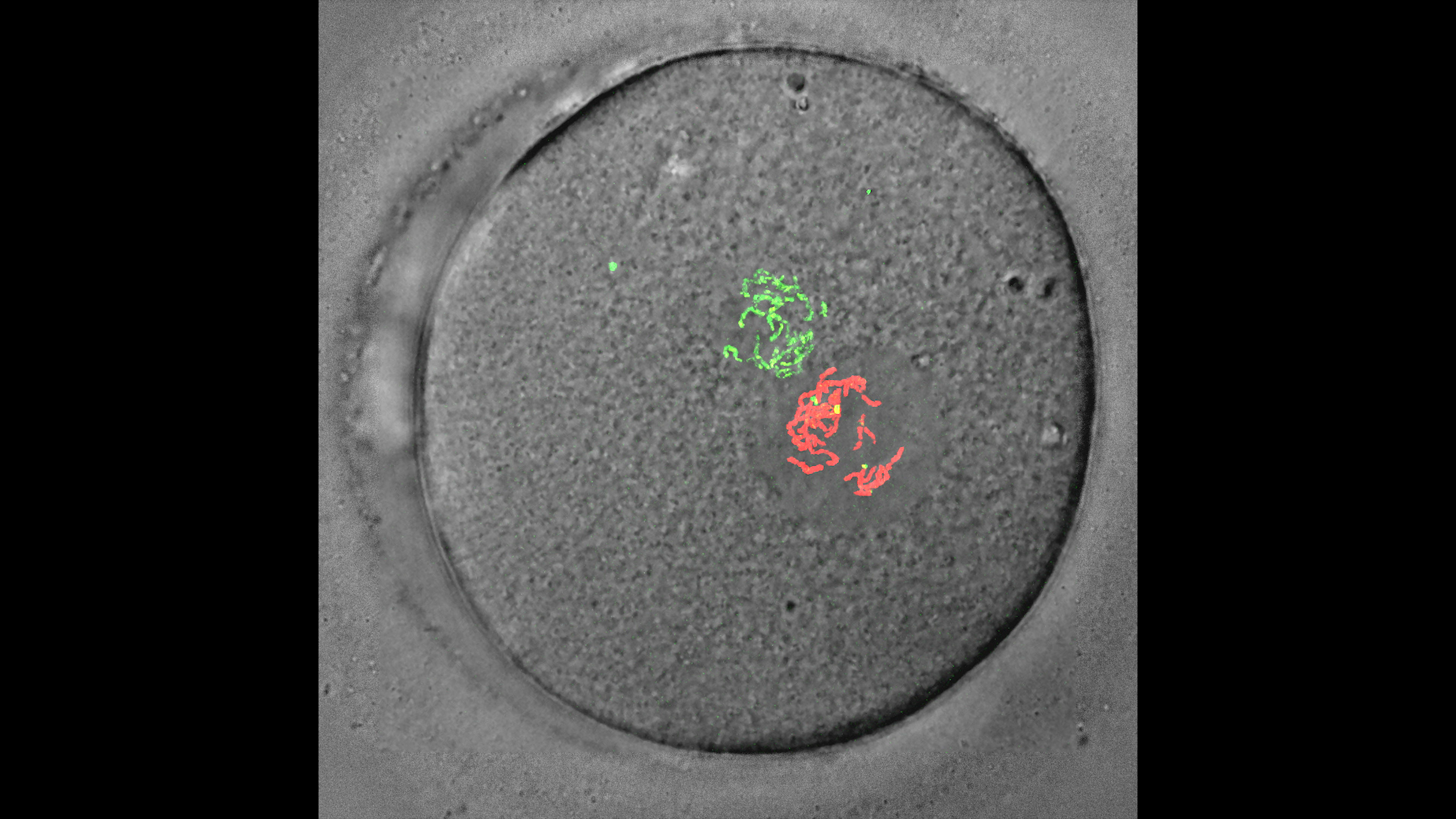 受精卵の画像。緑色は母親の染色体、オレンジ色は父親の染色体。この後、両者の染色体が並ぶことで子ども独自の染色体がそろう。（画像：山縣一夫・近畿大学）
