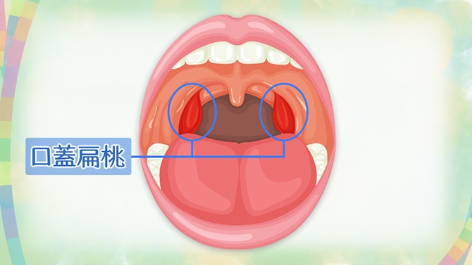 IgA腎症の原因で有力なのが口蓋扁桃（こうがいへんとう）の免疫の異常