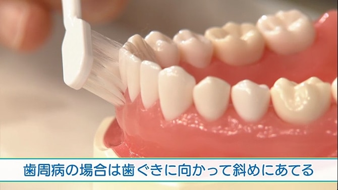 歯周病の場合は歯ぐきに向かって斜めにあてる