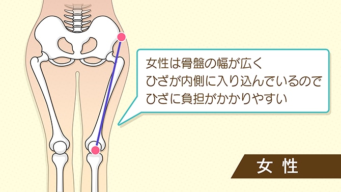 更年期の女性がひざを痛めやすい理由