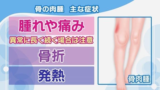 NHK健康チャンネルで確かな医療・健康情報を肉腫（サルコーマ）とは？骨の肉腫・軟部肉腫それぞれの症状と検査について