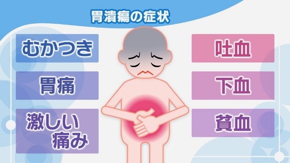 胃潰瘍の症状