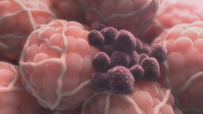 「がんを抑える遺伝子」に働きかける！注目の最新治療