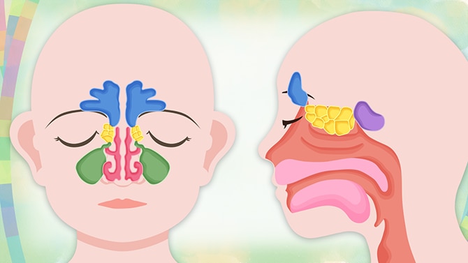 鼻づまりや鼻水だけじゃない慢性副鼻腔炎の症状・診断・治療法を解説