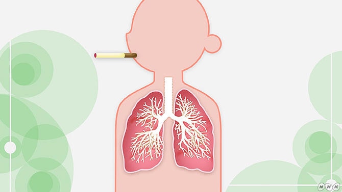肺の病気たばこが原因の慢性閉塞性肺疾患「COPD」とは