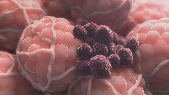 がんの最新治療！DNAメチル化酵素をコントロールしてがんを抑える