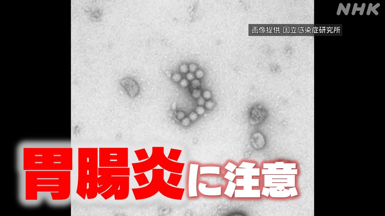 症状と対策を解説 鳥取県内で流行「感染性胃腸炎」