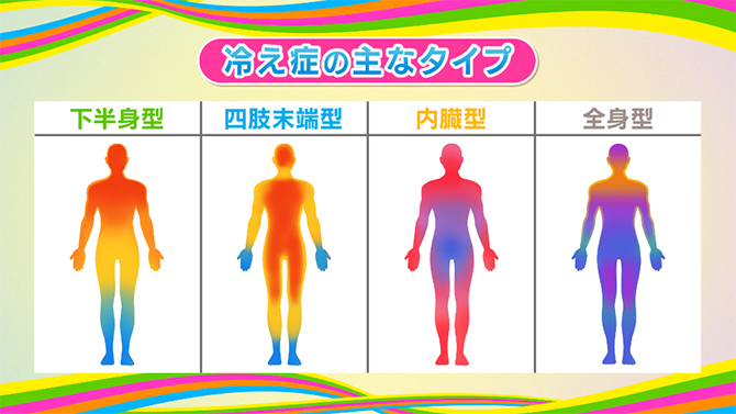 主な冷え性のタイプ。下半身型、四肢末端型、内臓型、全身型